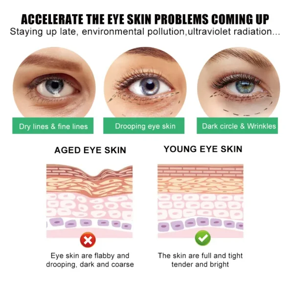Day and Night  Eye Cream for Dark Circles and  Eye Bags Removal ᵈᵃʳᵏ Herbs & Vitamins