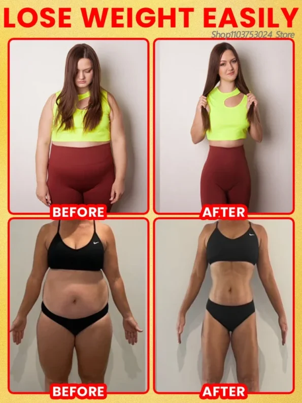 Anti Cellulite Weght Loss Massage Oil allowing Health Care Products